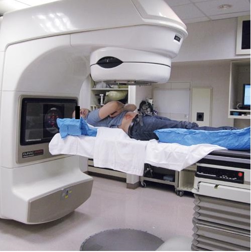 Radiation Therapy